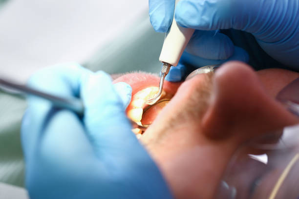 Best Emergency Denture Repair in East Hemet, CA