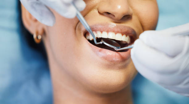Best Same-Day Emergency Dental Services in East Hemet, CA